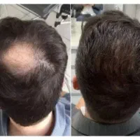دیگه وقتشه با نانو کیت آشنا شید