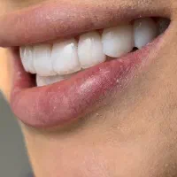 کامپوزیت لمینیت