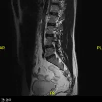 دیسک کمروگردن،متقاضی کارم