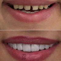 * تخفیف ویژه خدمات دندانپزشکی در رباط‌کریم