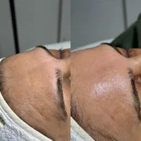 نیازمند مدل تمامی تکنیک های فیشال