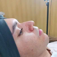 خدمات زیبایی فـیلـربـوتـاکـس