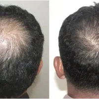 با راه طبیعی درمان شو