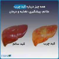 خداحافطی با کبد چرب