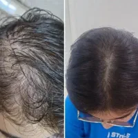 فقط با این محصوله که پرپشت میشه