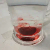 سنگگ هبهاب خونی پر روزی .