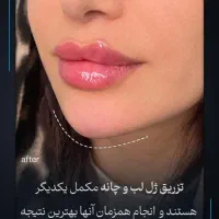 «دکتر کامبیز محمدپور»گلدیلاک،روسی، اورجینال