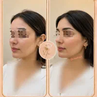کلینیک زیبایی رز سفید 30 % off تابستانه