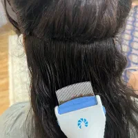 پاکسازی شپش و رشک بایک جلسه تضمینی