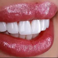 آفر ویژه کامپوزیت در شیراز هر فک فقط ۱۴ تومان