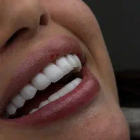 به یک منشی دندانپزشکی جهت بازار یاب نیازمندیم