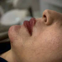 ورکشاپ تخصصی و علمی ژل و بوتاکس