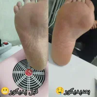 خدمات پدیکور