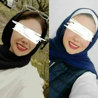 تپلی صورت توی ۲۰ روز