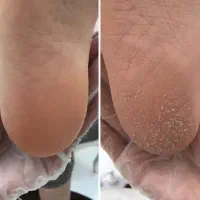 کف سابی و پدیکور و بادکش درمانی رز