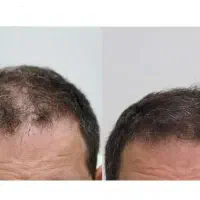 شادی دوباره رو به خودت برگردون