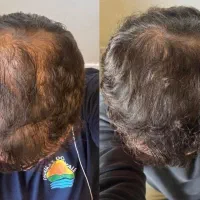 راهکارهای نوین مراقبت از مو
