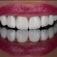 دندانپزشکی با شرایط ویژه اقساط