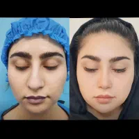 جشن تخفیف زیبایی بینی فقط دو روز کلا 69 تومان
