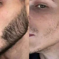 ریشات فقط به این نیاز داره