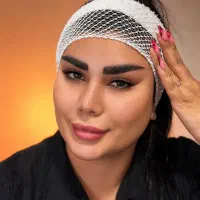 کاشت ابروبا متد جدید در بوکان