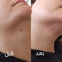 تمامی لاین های زیبایی