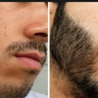 از افسردگی نجاتت میدم