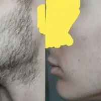 اقدام مساوی نتیجه‌گیری