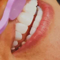 خدمات تخصصی دندانپزشکی ترمیمی و زیبایی