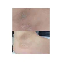 پاکسازی پوست