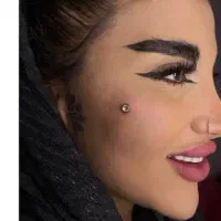مرکز  )(۵۰ درصداف کاشت نگین اموزش میکرودرمال