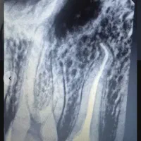استخدام(دندانپزشک متخصص ایمپلنت)