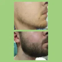 مرد باش|آرایشی، بهداشتی، درمانی|قائن, |دیوار