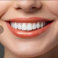 خدمات دندانپزشکی کلینیک ایرانمهر با تخفیف ویژه