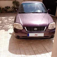 هیوندای ورنا