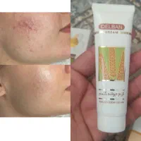 کرم جوانه گندم جایگزین بوتاکس
