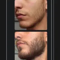 رویش ریش و سبیل