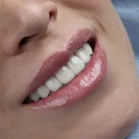دستیار دندانپزشک