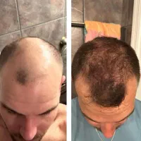 رویشی پرتراکم تجربه کن