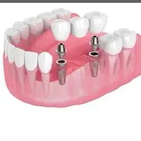 دندانپزشکی آرین( تعرفه مناسب و اقساط)