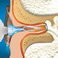 شستشوی گوش،برداشت خال،ژل،بوتاکس،ودیگر خدمات زیبایی