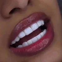 کامپوزیت دندان بدون هزینه اضافه با قیمت های واقعی