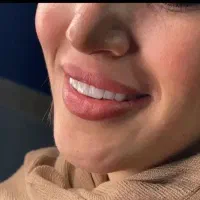 وام 4درصدی برای خدمات دندان پزشکی