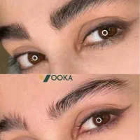میکروبلیدینگ فیبروز ابرو شیدینگ لب