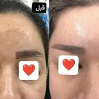 مراقبت پوست جوانه‌گندم