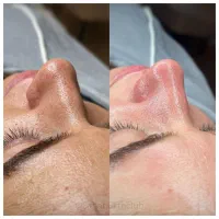 پاکسازی و‌ جوانسازی تخصصی