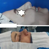 عمل بینی/سانترال لب/بلفارو پلاستی|خدمات آرایشگری و زیبایی|مشهد, احمدآباد|دیوار