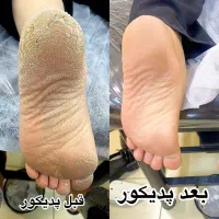 فیشیال تخصصی پوست و پدیکور روسی سالن هیژان قم