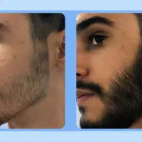ریش پر‌ ابهت تر