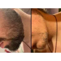جذاب کننده چهره آاقایون